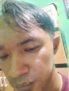 Terulang Dianiaya, Seorang Pria Warga Rawajati Lapokan Istri Sirih ke Polda Metro Jaya